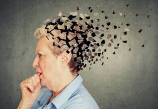 Uzmanı uyardı: ‘Demans ile Alzheimer tıpkı hastalık değil’
